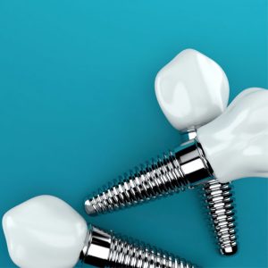 dental implants on isolated background
