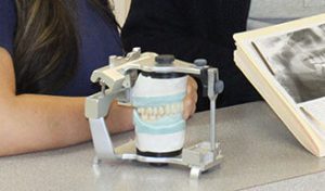 A model of a dental bridge, sitting on a table, with an x-ray image of teeth to the right
