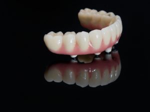 implant-supported dentures